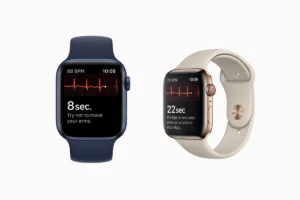 Apple Watch ECG